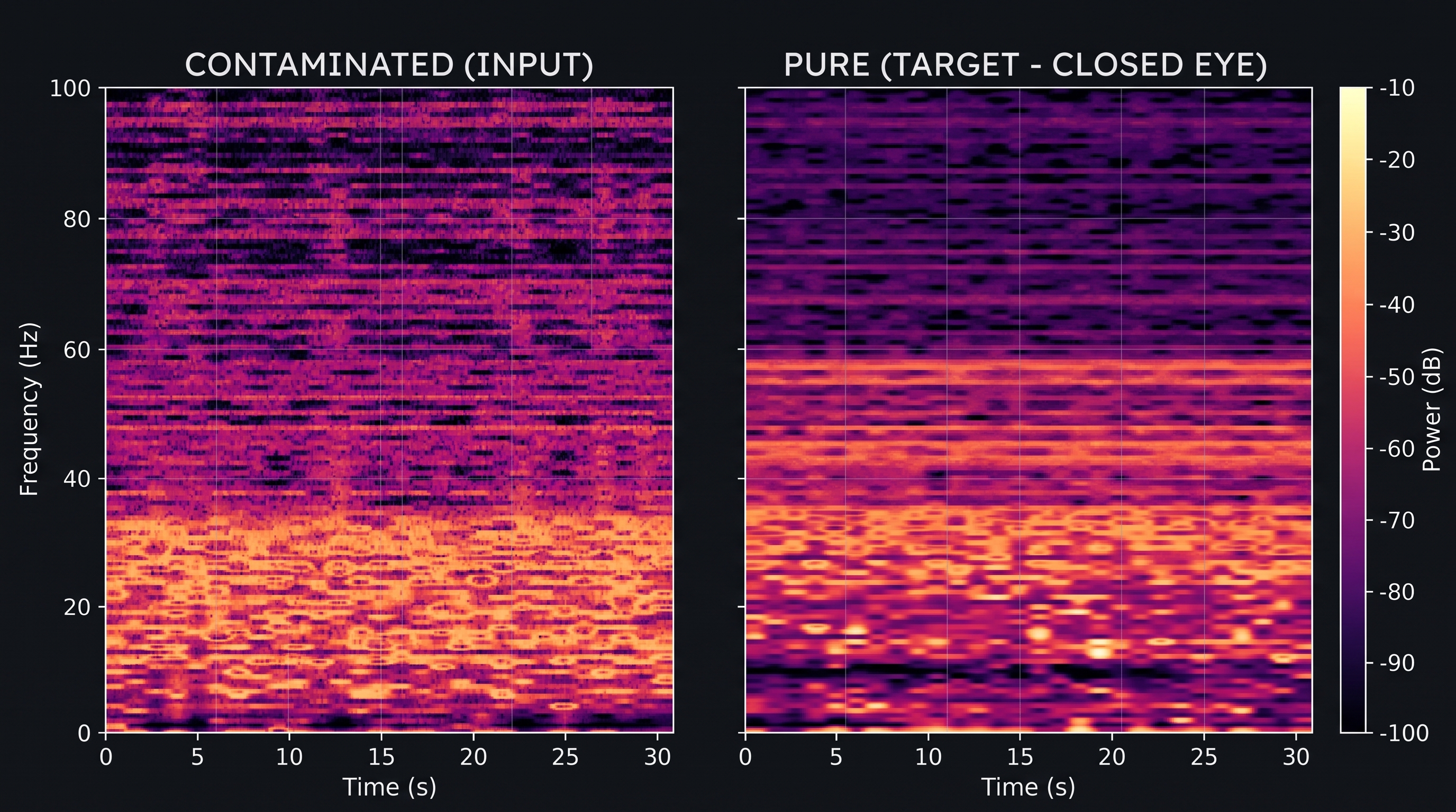 EEG Ocular Artifact Denoising — result 1 of 3